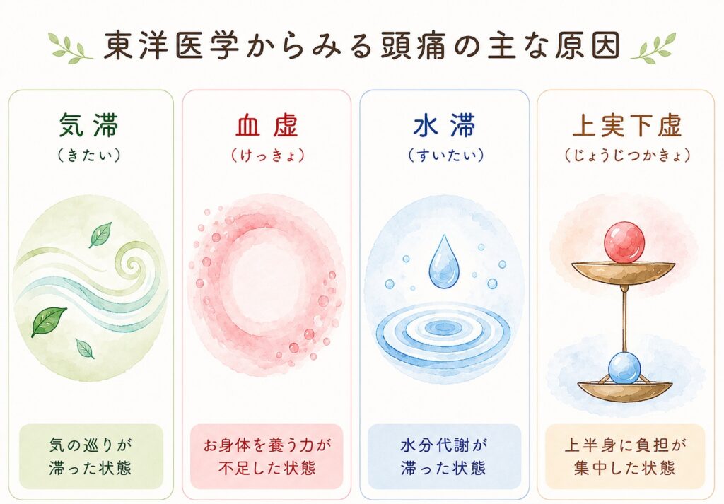 東洋医学でみる頭痛の主な原因(気滞・血虚・水滞・上実下虚)のイラスト